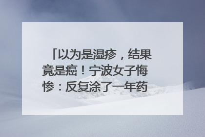 以为是湿疹,结果竟是癌!宁波女子悔惨:反复涂了一年药膏都没好!很多患者首诊都去了皮肤科