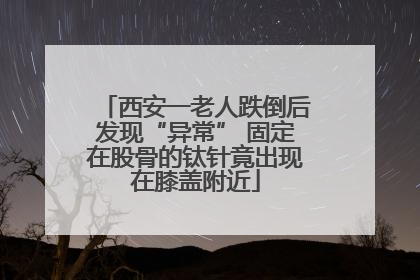 西安一老人跌倒后发现“异常” 固定在股骨的钛针竟出现在膝盖附近